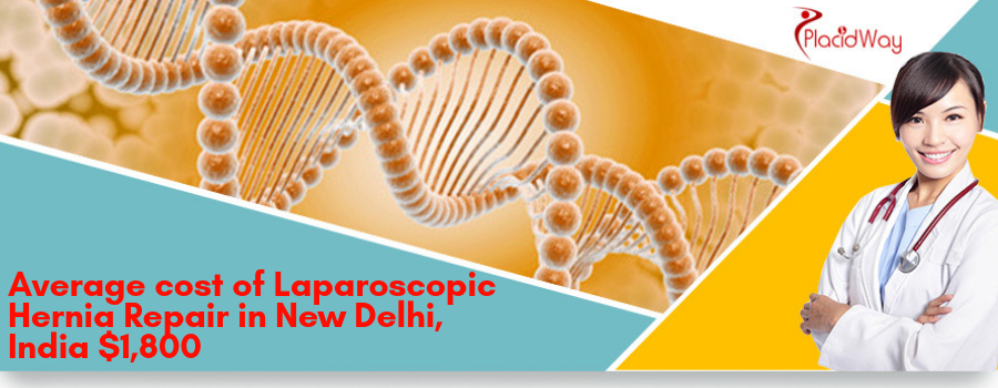 Cost of Laparoscopic Hernia Repair in New Delhi, India